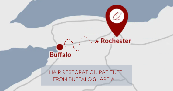 map of Buffalo to Rochester, Hair Restoration Patients From Buffalo Share all
