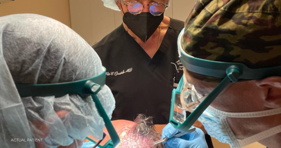 Dr. Quatela and hair team transplanting hair grafts into patient scalp