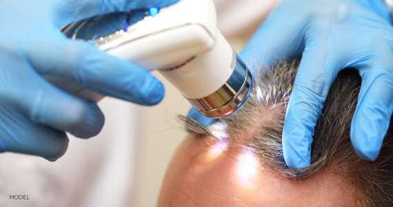 close up of scalp, gloved hands using trichoscope